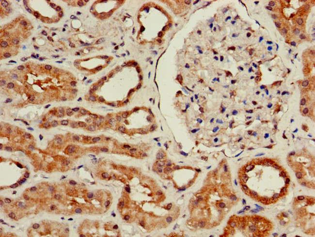 WISP3 Antibody in Immunohistochemistry (Paraffin) (IHC (P))