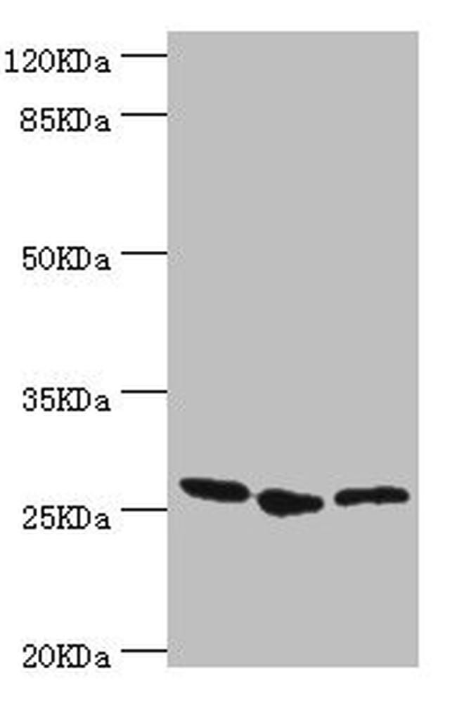 GAS41 Antibody in Western Blot (WB)