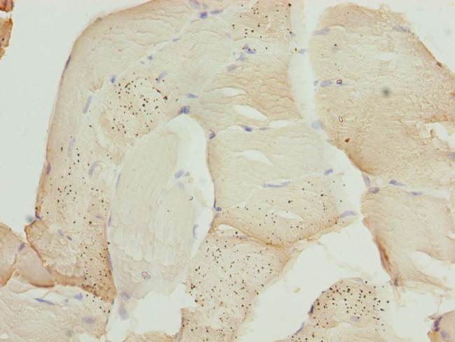 ZBTB25 Antibody in Immunohistochemistry (Paraffin) (IHC (P))
