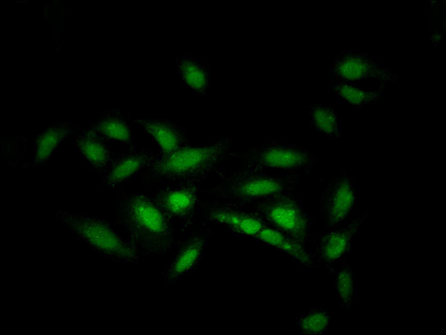 ZNF133 Antibody in Immunocytochemistry (ICC/IF)