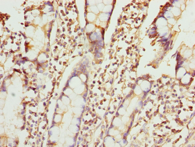 ZNF169 Antibody in Immunohistochemistry (Paraffin) (IHC (P))