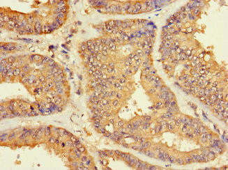 ZNF2 Antibody in Immunohistochemistry (Paraffin) (IHC (P))