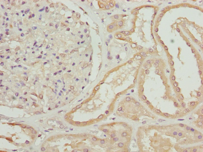 ZNF24 Antibody in Immunohistochemistry (Paraffin) (IHC (P))