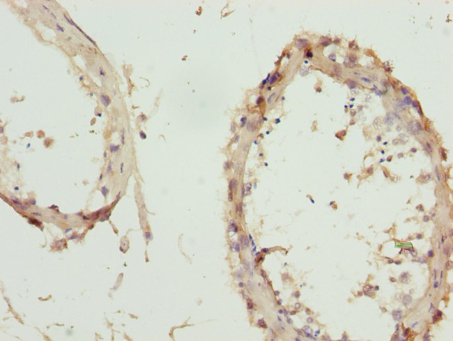 ZNF264 Antibody in Immunohistochemistry (Paraffin) (IHC (P))