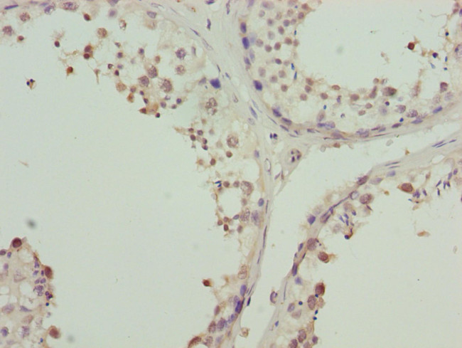 ZNF264 Antibody in Immunohistochemistry (Paraffin) (IHC (P))