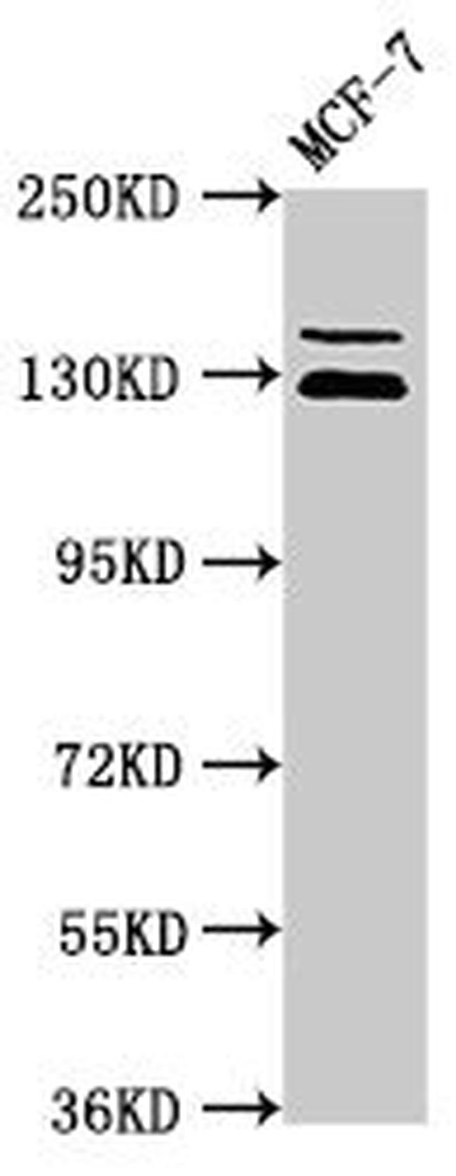 ZNF335 Antibody in Western Blot (WB)