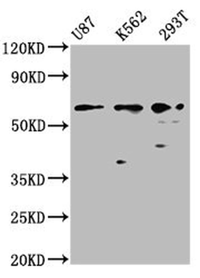ZNF37A Antibody in Western Blot (WB)
