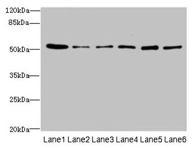 ZNF398 Antibody in Western Blot (WB)