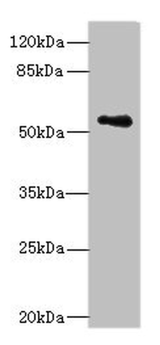 ZNF434 Antibody in Western Blot (WB)