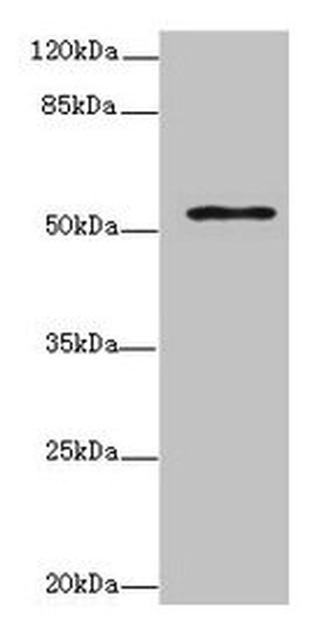 ZNF610 Antibody in Western Blot (WB)