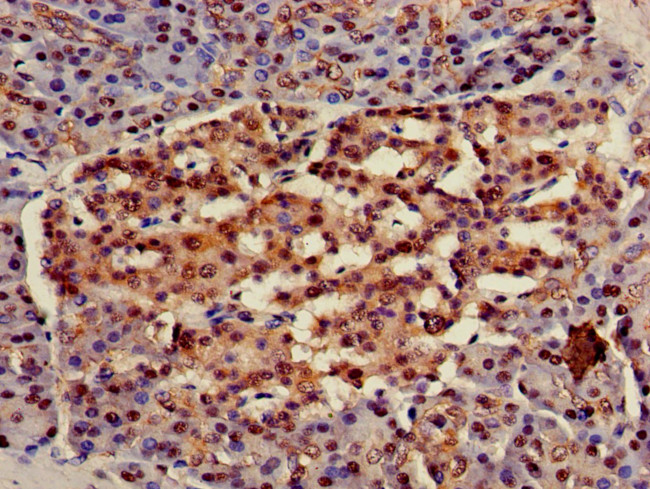 HSC70 Antibody in Immunohistochemistry (Paraffin) (IHC (P))