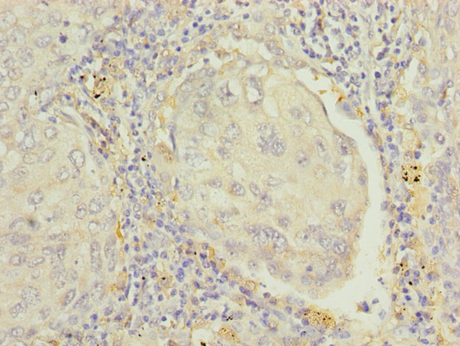 RAP1B Antibody in Immunohistochemistry (Paraffin) (IHC (P))