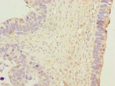 HSP40 Antibody in Immunohistochemistry (Paraffin) (IHC (P))