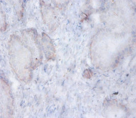 AFG3L2 Antibody in Immunohistochemistry (Paraffin) (IHC (P))