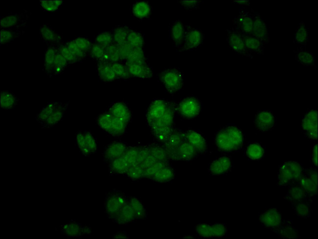 API5 Antibody in Immunocytochemistry (ICC/IF)