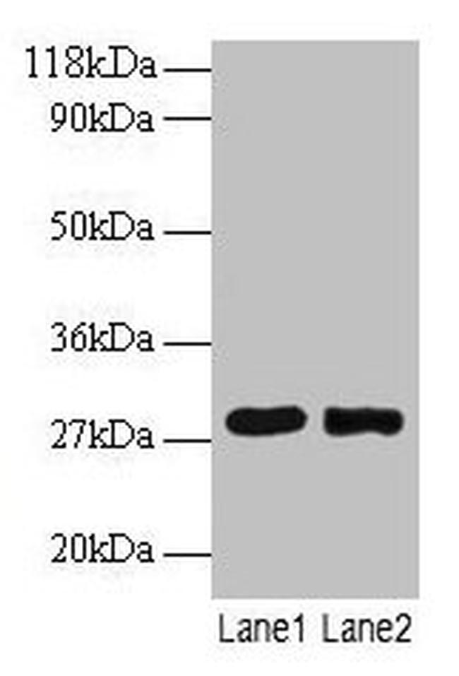 MPZ Antibody in Western Blot (WB)