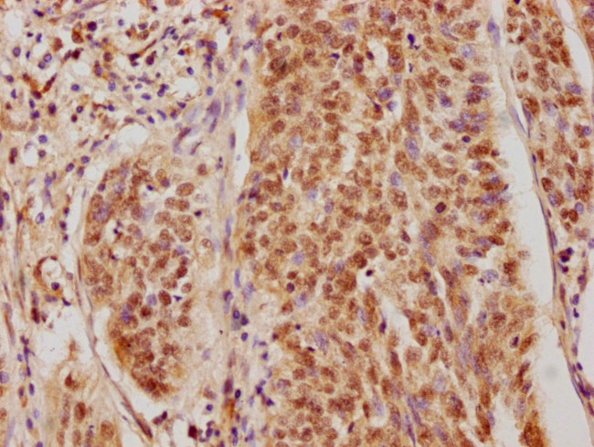 CSNK2A3 Antibody in Immunohistochemistry (Paraffin) (IHC (P))