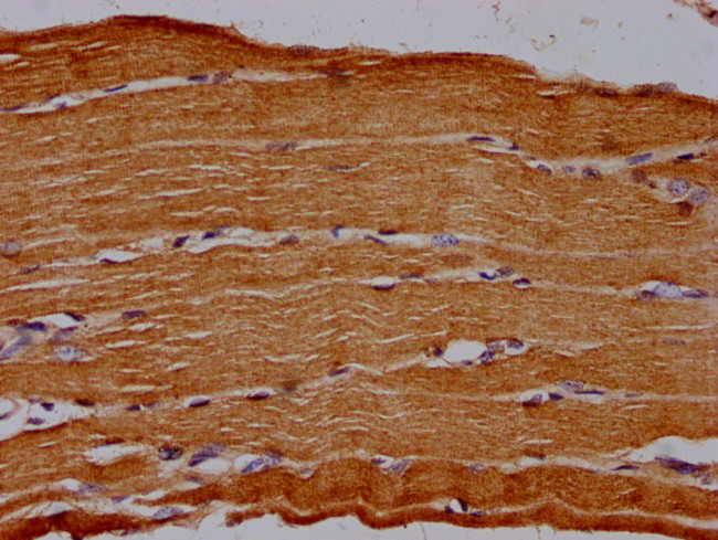 CD73 Antibody in Immunohistochemistry (Paraffin) (IHC (P))