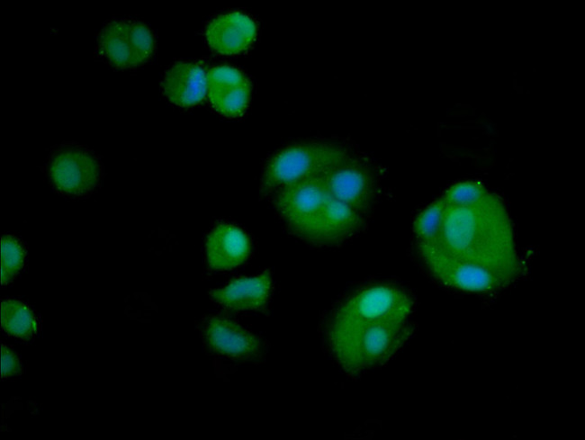 AMH Antibody in Immunocytochemistry (ICC/IF)