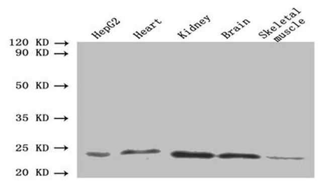 ORM2 Antibody in Western Blot (WB)