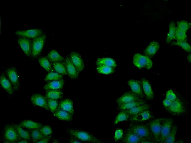 Kininogen Light Chain Antibody in Immunocytochemistry (ICC/IF)
