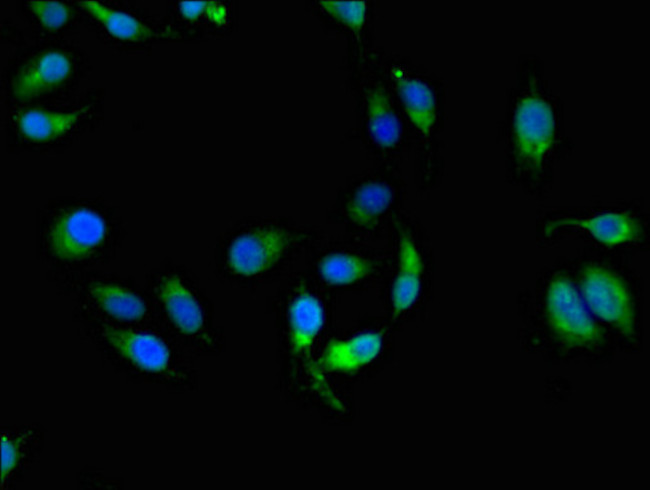 HLA-ABC Antibody in Immunocytochemistry (ICC/IF)