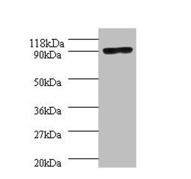 POLA1 Antibody in Western Blot (WB)