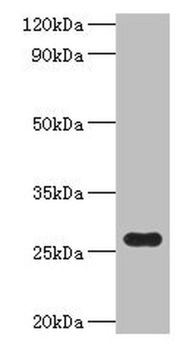FRE Antibody in Western Blot (WB)