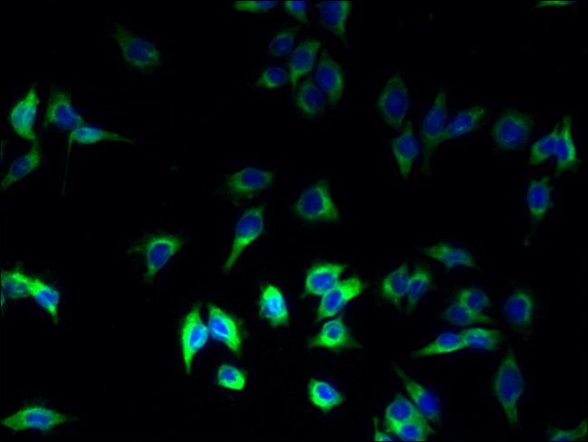 HLA-DRB1 Antibody in Immunocytochemistry (ICC/IF)