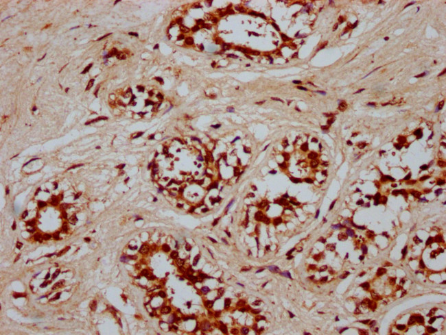 POU5F1B Antibody in Immunohistochemistry (Paraffin) (IHC (P))