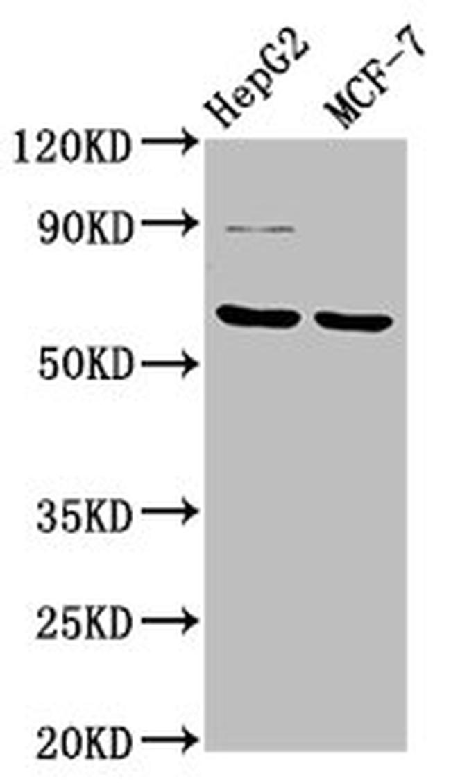 FPGS Antibody in Western Blot (WB)