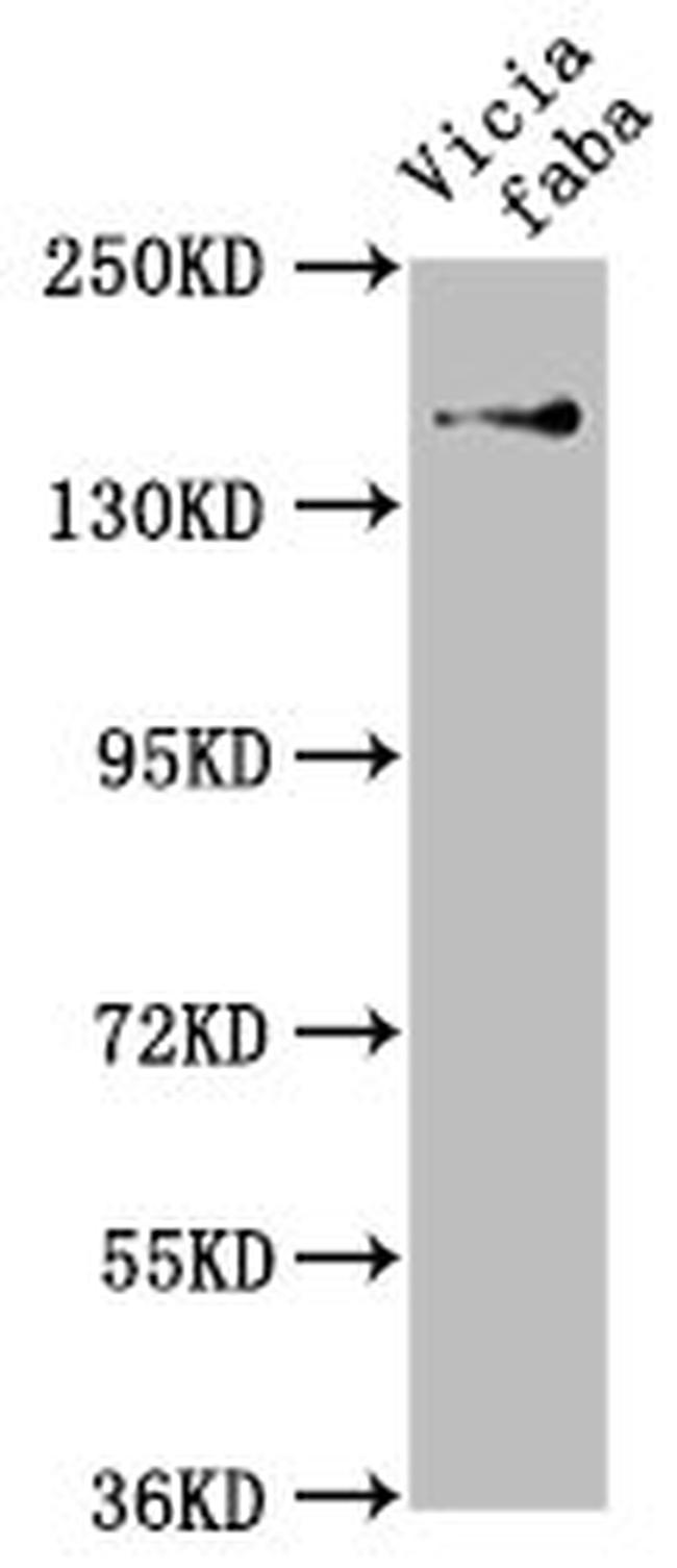 GLU1 Antibody in Western Blot (WB)