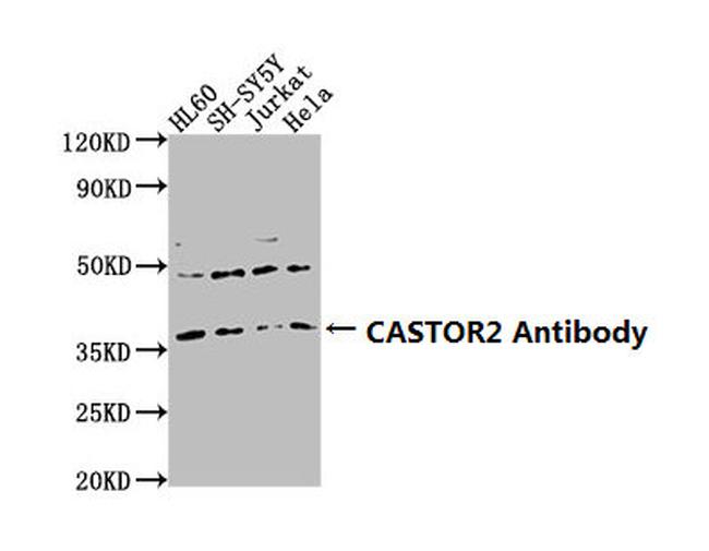 GATSL2 Antibody in Western Blot (WB)