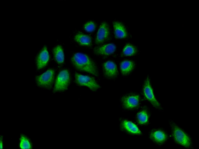 HLA-DRB3 Antibody in Immunocytochemistry (ICC/IF)