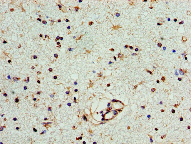 PNP Antibody in Immunohistochemistry (Paraffin) (IHC (P))