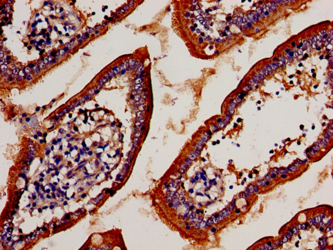 TCR V beta 7-9 Antibody in Immunohistochemistry (Paraffin) (IHC (P))