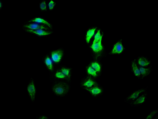 RMP Antibody in Immunocytochemistry (ICC/IF)
