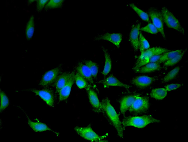 OS9 Antibody in Immunocytochemistry (ICC/IF)