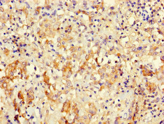 ICT1 Antibody in Immunohistochemistry (Paraffin) (IHC (P))