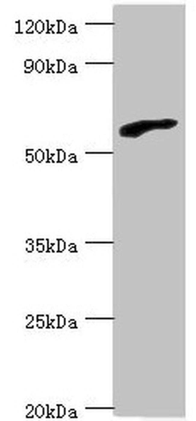RBBP5 Antibody in Western Blot (WB)