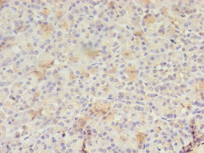 RAB30 Antibody in Immunohistochemistry (Paraffin) (IHC (P))