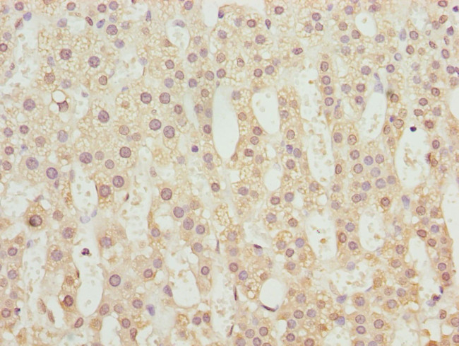 TBCE Antibody in Immunohistochemistry (Paraffin) (IHC (P))