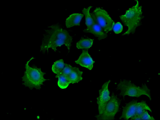 BRK Antibody in Immunocytochemistry (ICC/IF)