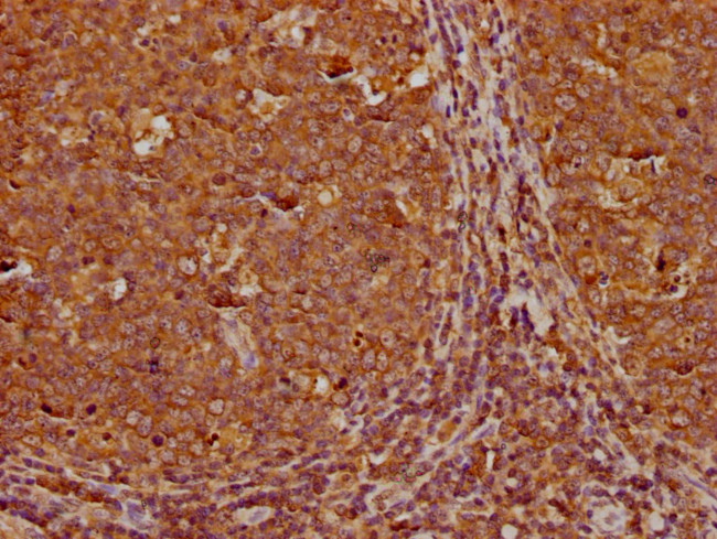 RABEP1 Antibody in Immunohistochemistry (Paraffin) (IHC (P))