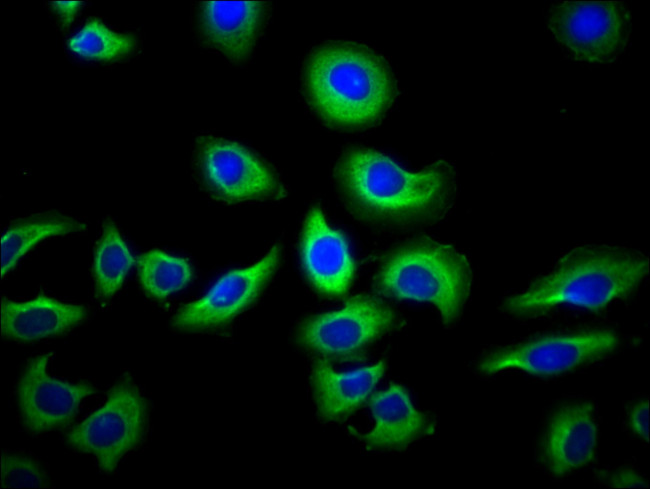 NAIP Antibody in Immunocytochemistry (ICC/IF)