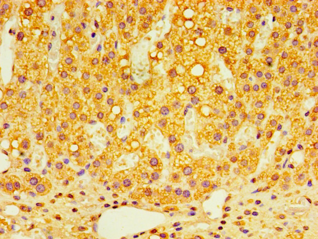 GPS1 Antibody in Immunohistochemistry (Paraffin) (IHC (P))