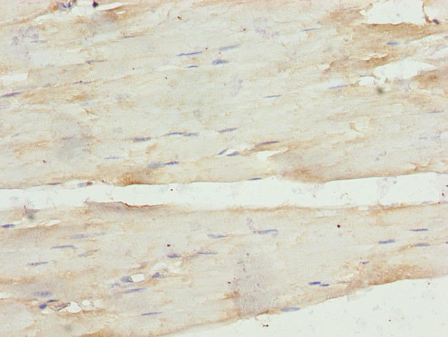 CARP Antibody in Immunohistochemistry (Paraffin) (IHC (P))