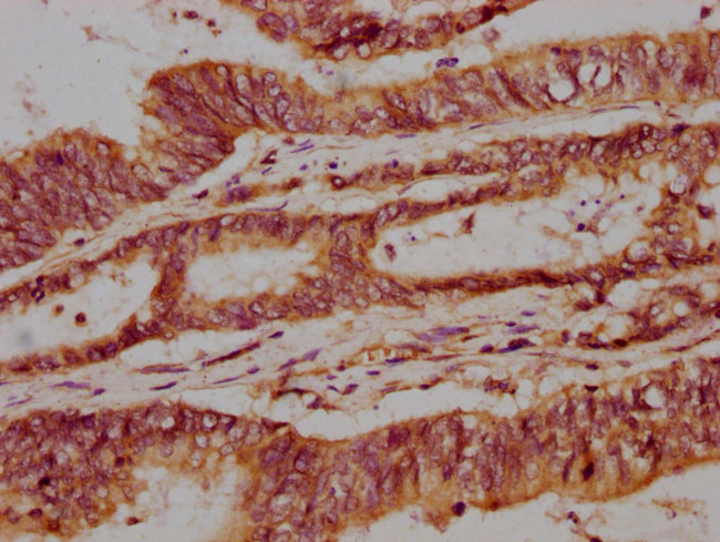 NPRL3 Antibody in Immunohistochemistry (Paraffin) (IHC (P))