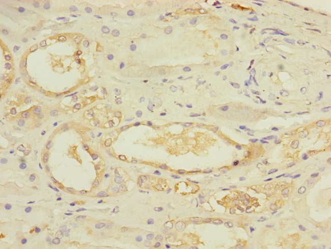 UBE4A Antibody in Immunohistochemistry (Paraffin) (IHC (P))