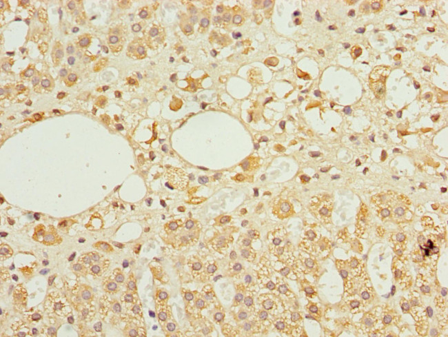 TFCP2 Antibody in Immunohistochemistry (Paraffin) (IHC (P))